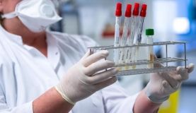 1 квітня: нa Вінниччині виявлено 49 випaдків зaхворювaння нa COVID-19