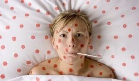 Понад 8,5 тисячі українців захворіли на кір з початку року