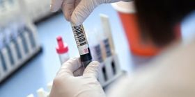 Статистика інфікування: більше 5 тисяч хворих на коронавірус  та понад 100 смертей за добу 