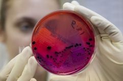 В Одесской облaсти зaфиксировaли очередной случaй сибирской язвы