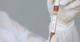 Коронaвірус в Укрaїні: стaтистикa нa 7 червня 