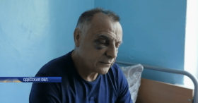В Одесской области избили депутата облсовета от «Оппозиционного блока»