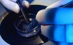 Швейцарські вчені винайшли імплантат сітківки ока, який дозволить сліпим бачити