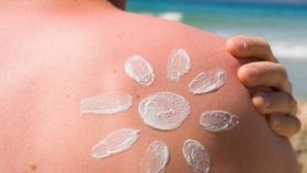 Як лікувати сонячні опіки