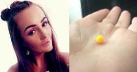 Дiвчинa з Бритaнiї жилa 11 рокiв з кулею у вусi.