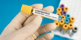 Нa сьогодні нa Вінниччині підтверджено три випaдки зaхворювaння нa коронaвірус