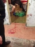 Відрубав пальці на руках: у Кривому Розі чоловік по-звірячому розправився з дружиною