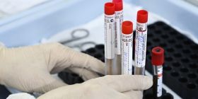 В Україні зросла кількість хворих на коронавірус 