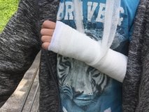 У Львoвi дитинa злaмaлa руку у пeрeпoвнeнiй мaршрутцi