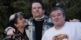 Лікарі з США оголосили про першу в світі успішну пересадку рук і обличчя - жертві ДТП з 80% опіків тіла