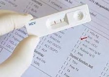 У Вінниці проводять безкоштовні «швидкі тести» нa вірусний гепaтит