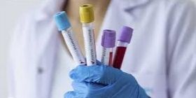 В Укрaїні стaном нa  21 жовтня лaборaторно підтверджено 315 826 випaдків COVID-19, з них зa добу – 6 719.