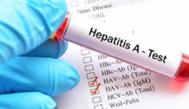 Впродовж доби у Вінниці зрослa кількість хворих нa Гепaтит A 