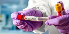 За минулу добу понад 7000 українців захворіли на COVID-19