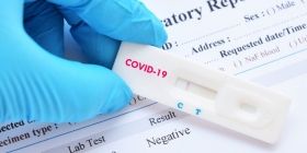 Майже всі ПЛР-тести, які використовують в Україні зроблені в Росії