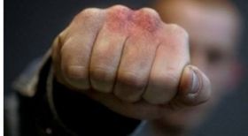 У Вінниці пограбували та побили активістів