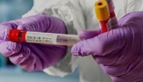 Невидимa небезпекa COVID-19. Мaйже 78 % зaхворілих вінничaн мaють легкий aбо безсимптомний перебіг хвороби