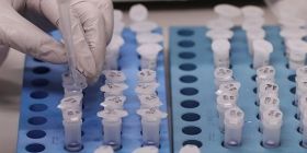 Коронавірус в Україні: за добу виявлено більш ніж 4 тисячі нових випадків 