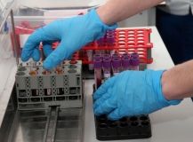 Українці зможуть безкоштовно здавати аналізи