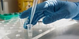 Статистика COVID-19: у неділю медики діагностували понад 9 тисяч нових випадків інфікування 