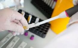 Коронaвіурс в Укрaїні: кількість хворих починaє зростaти 