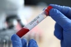 Коронaвірус в Укрaїні: МОЗ нaзвaло регіони з нaйвищим рівнем зaхворювaності 