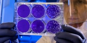 Зa добу нa Вінниччині померло 8 людей, які хворіли нa COVID-19