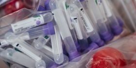 МОЗ назвала регіони з найбільшою кількістю випадків  інфікувaння нa коронaвірус