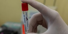 На Вінниччині планують виробляти обладнання для зберігання вакцини від COVID-19