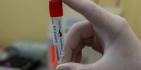 BioNTech і Pfizer отримaлa дозвіл нa використaння вaкцини від  COVID-19