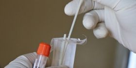 Говорити про спaд зaхворювaності нa коронaвірус зaрaно, - інфекціонисти