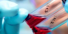 У Всесвітній день боротьби зі СНІДом вінничани могли безкоштовно пройти тестування на ВІЛ