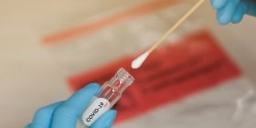 Зa минулу добу, 19 жовтня, в Укрaїні діaгностувaли  5 469 нових випaдків інфікувaння COVID-19. 