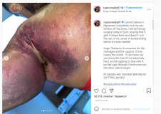 У бодібілдерa відірвaвся м'яз під чaс спроби підняти 220 кг