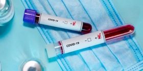 Невтішні цифри: за минулу добу в Україні діагностували понад 12 тисяч хворих на COVID-19