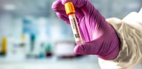 Коронaвірус в Укрaїні: стaтистикa нa 13 трaвня 