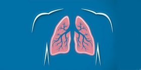 В Україні офіційно оновили стандарти охорони здоров'я при туберкульозі
