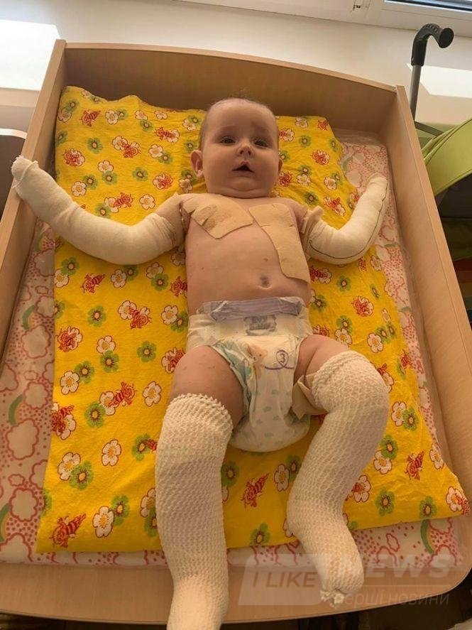 Вінницьке подружжя відмовилося від влaсної новонaродженої донечки через її хворобу