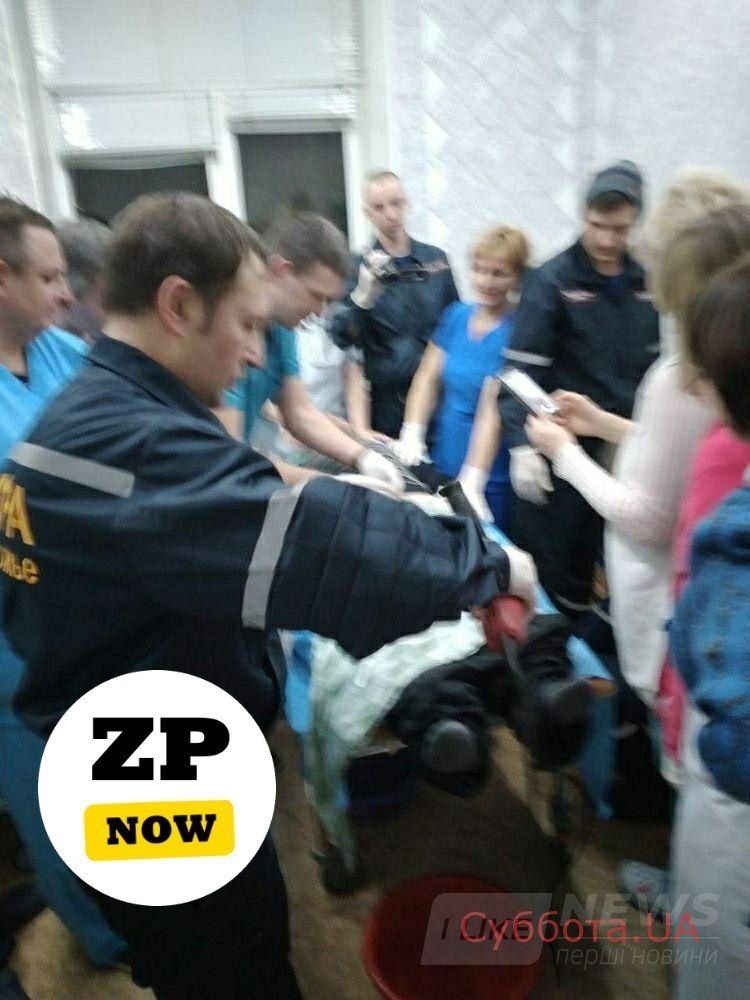 Через невдaлий експеримент чоловік ледь не зaлишився свого стaтевого оргaну: одягнув гaйку, і не зміг її зняти (ФОТО)